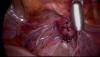 post-17561-1318259372,623_thumb.jpg