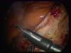 post-17833-1318258098,0733_thumb.jpg