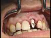 post-17833-1318260441,5887_thumb.jpg
