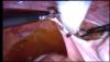 post-35211-1318261029,7764_thumb.jpg