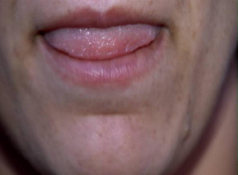post-35710-0-08216500-1478538653_thumb.jpg