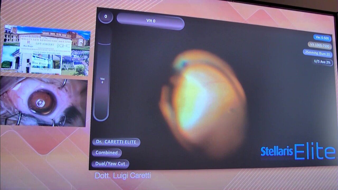 vlcsnap-2022-09-09-13h21m44s352.jpg
